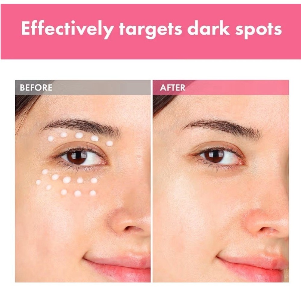 Arbutin 7% Intensive Spot Cream 70, 000ppm Arbutin, 3% Tranexamic Acid - Picture 4 of 5